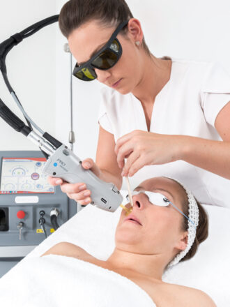 GENTLE MAX PRO CANDELA - DEPILACJA LASEROWA - WĄSIK PLUS BRÓDKA