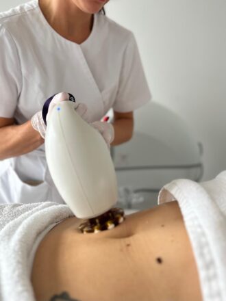ICOONE LASER MED 2 – DRENAŻ + 2 FOCUSY - PAKIET 10 ZABIEGÓW (40 min) PLUS 2 ZABIEGI ALMA RF NA BRZUCH GRATIS