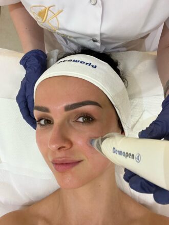 Dermapen 4.0 - pakiet trzech zabiegów na twarz