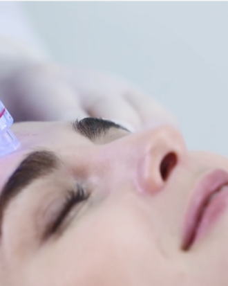 AQUAPEEL HYDROPEELING - 3 ETAPOWE OCZYSZCZANIE NA TWARZ + KOMPUTEROWE BADANIE SKÓRY OBSERV520 X GRATIS